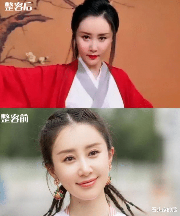 赵露思|盘点明星整容“翻车”现场，看她们是如何从“丑”变为“美！”！