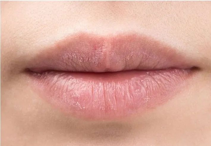 润唇膏 冬季嘴唇干裂、起皮?别再舔了!教你这么做,轻松拥有嘟嘟唇