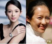 严选|河南女子花8000美白，两月后竟变“包公脸”？医生：难以恢复