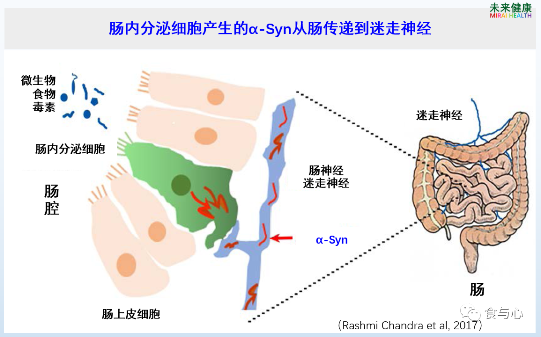 益生菌|补充益生菌能改善帕金森症吗？最新科研结果给出肯定回答
