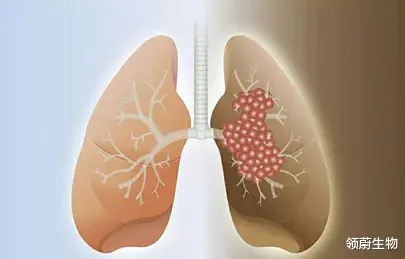 领蔚生物 超全总结：关于肺癌术后辅助治疗，一点要知道这5点！