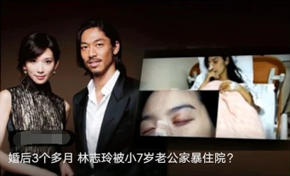 林志玲|林志玲“被家暴”为何不离婚？外媒报道成笑话，知道日本离婚有什么代价吗？