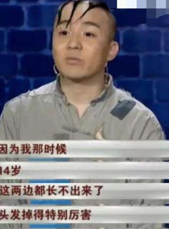 吴孟达|他凭“三毛”一夜爆红，因谢顶缝合300针，今容貌大变无人识