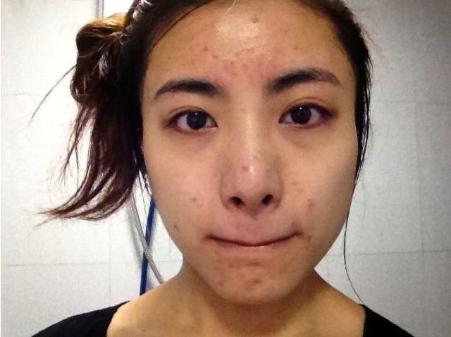 短发 美容院不会告诉你，“闭口”这样处理，在家也能养出细腻肌肤