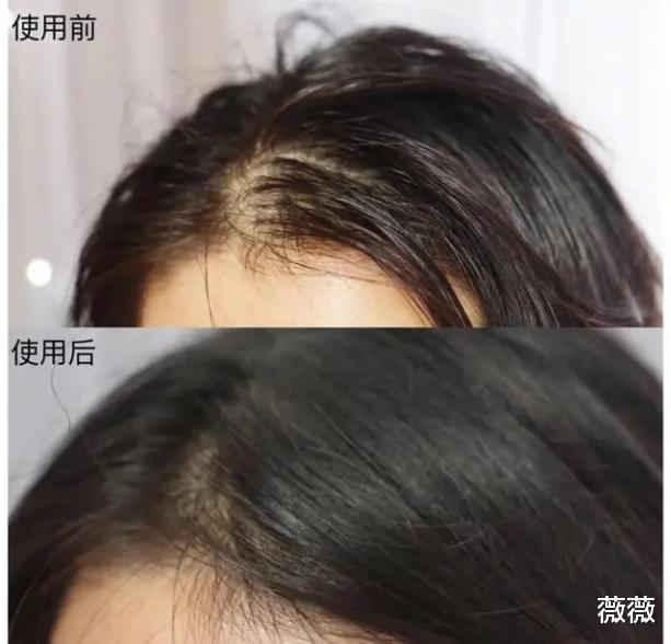 洗发水 四类被加入“黑名单”的洗发水，没少花钱还脱发，却老有人往家买