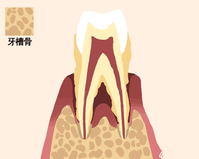 小智健康助手 牙周炎这个口腔黑暗大Boss，治好它就省了一个亿！