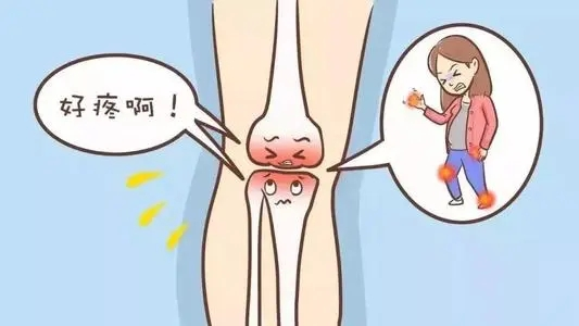 中康之家 膝盖疼痛、肿胀，该怎么办？