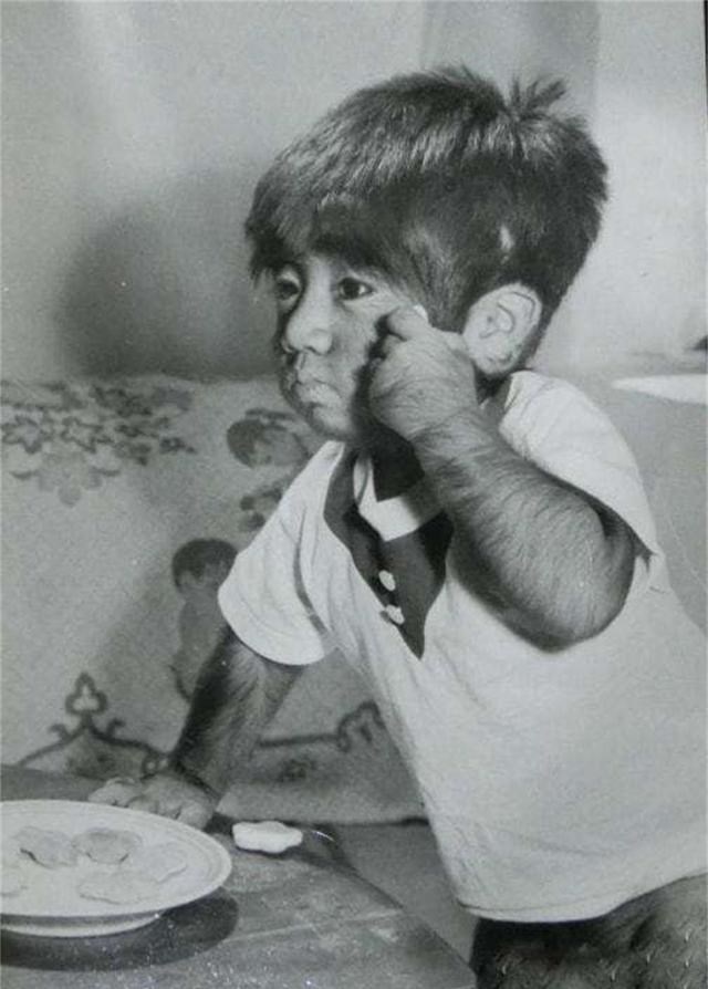 于震寰|中国第一毛孩于震寰：曾因外表异于常人火遍全国，如今已娶妻生子