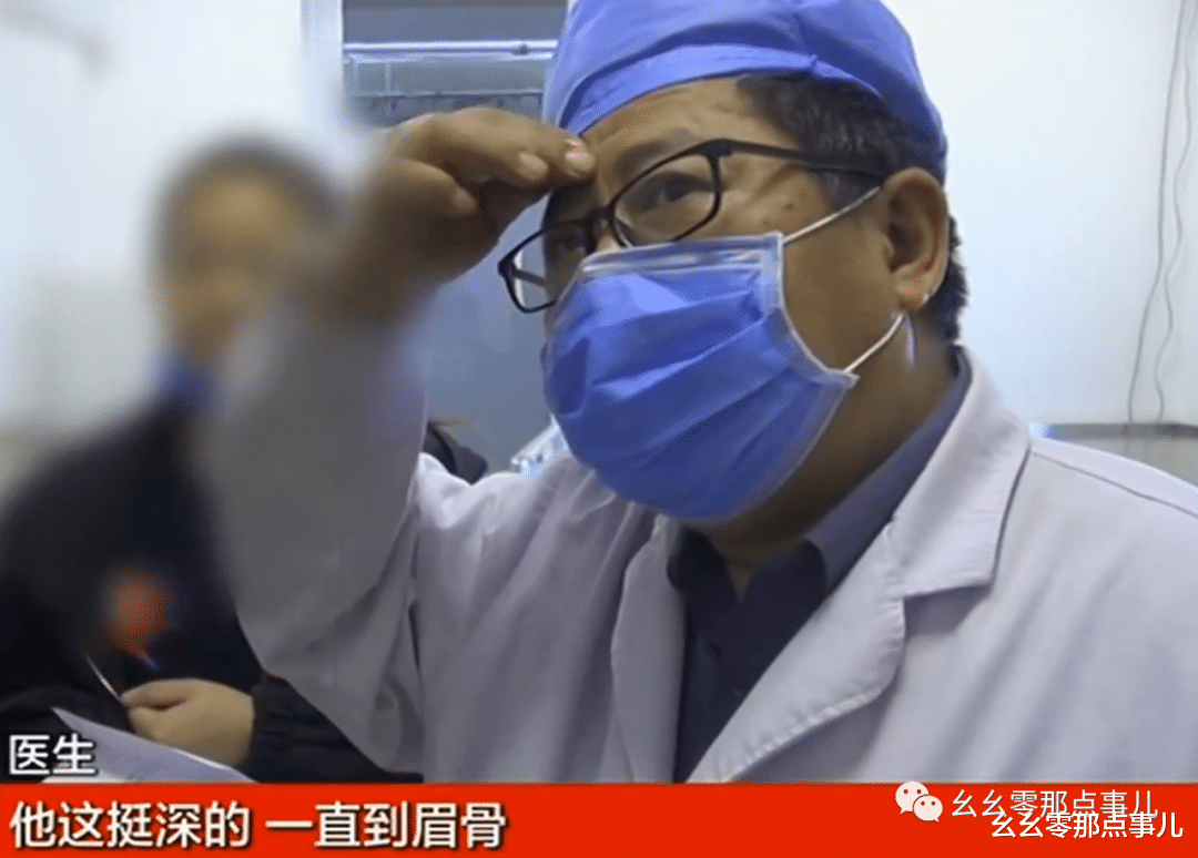 北京街头逆行,撞上外卖小哥!套牌摩托真嘚瑟,不戴头盔险些失明
