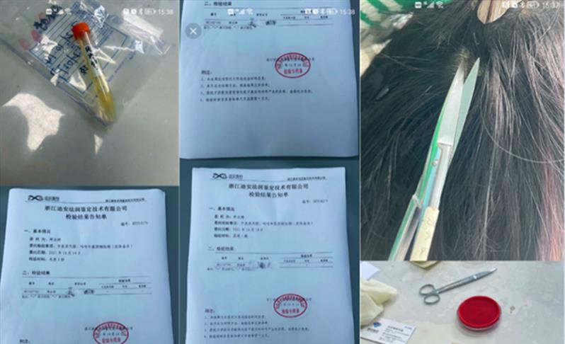 失控的小青蛙|200万粉丝网红猪有蹄流产10天被家暴成猪头照片曝光？药水哥发声