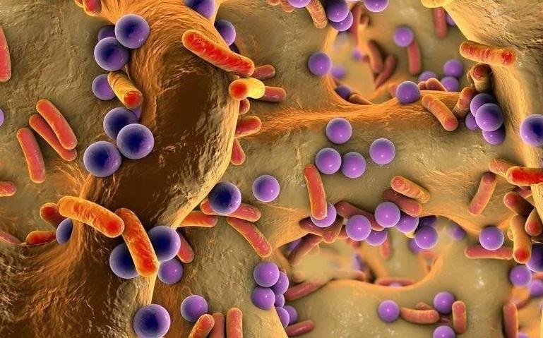 安神|明明没乱吃,肠道为什么会失调?先看看你有没有这几个习惯