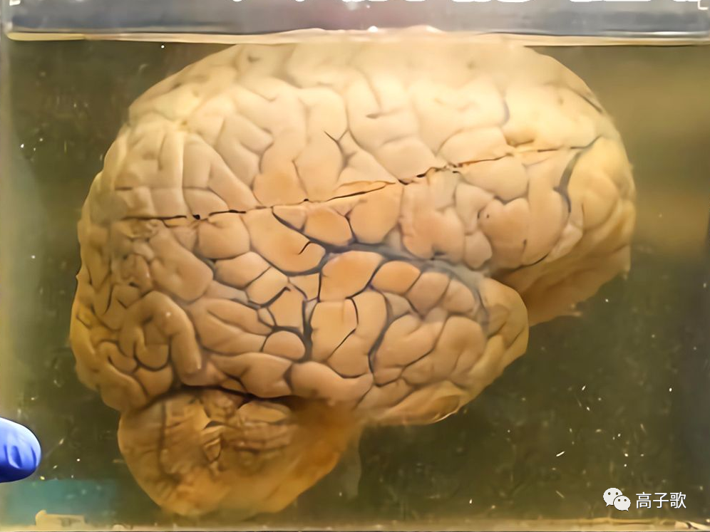 脑电波 如果你的大脑能够永生，但只能泡在营养液里，你愿意吗？