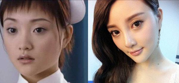 整容|6位整容的女明星曾经有多么美？别人是把自己变美，她们是整残了