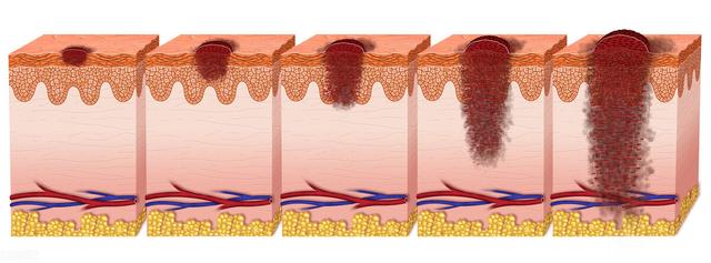 感冒|无论男女，多少岁开始有老年斑？做好三件事，或老了也能白白净净