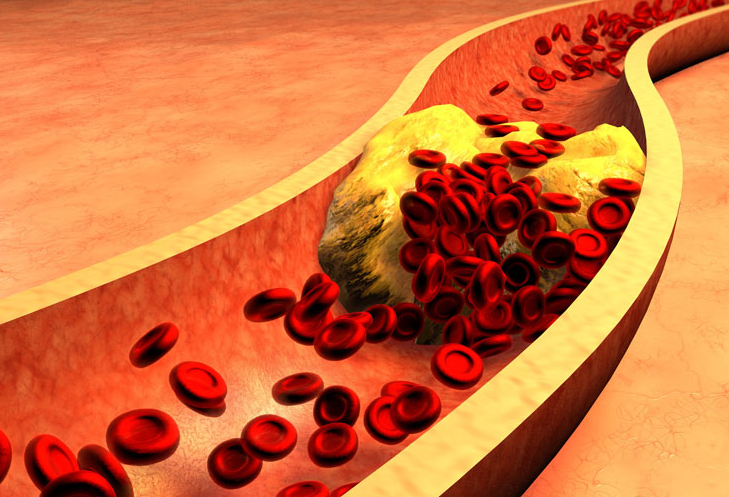 医生|52岁大爷血管犹如20岁小伙，平时常吃4种食物，血管科医生：做得好！