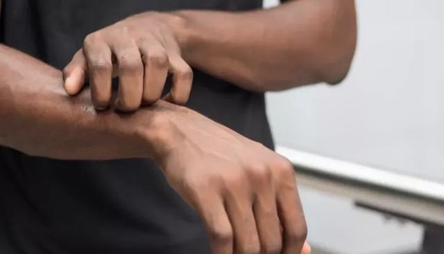 诗采春 肾功能受损，有哪些症状？如何判断一个男人肾好不好？