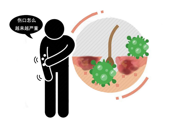 肝癌|肝癌来临，小便早就提示过？上厕所时，留意2种异常