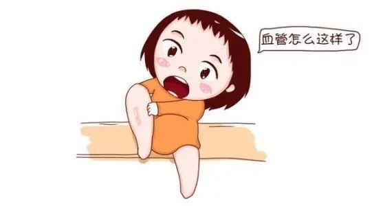 中康之家 缓解静脉曲张的方法有哪些？