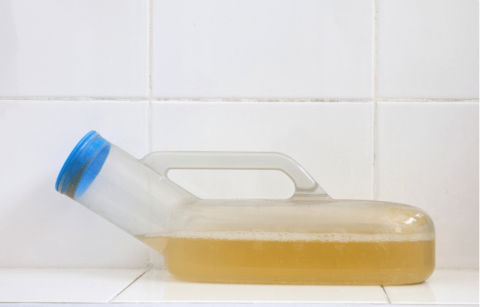 肾病|肾病肌酐升高后，尿量减少怎么办？2个方法可改善更护肾