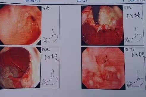 熊猫医学社|吃一次等于10瓶牛奶！消化科主任：若你爱吃，清幽养胃胃舒坦