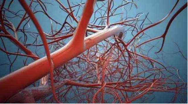 脑梗|45岁女老师脑梗离世，医生：天天吃2种素食，血管很容易堵塞