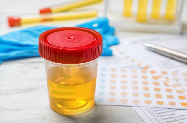 肝脏|肝火过旺,身体会发出5种“信号”,若一个不占,身体轻松