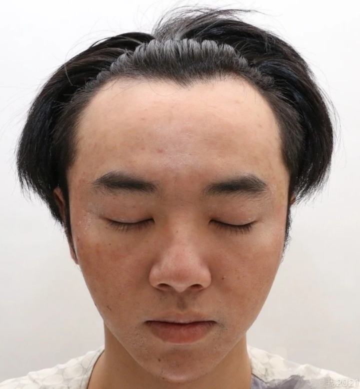 华晨宇|爆料者公开证据图，称有人威胁她造谣华晨宇整容植发，不然等着捞尸体