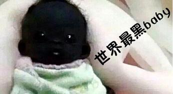 |那个被称作是\最黑婴儿\，因为肤色一夜爆红，6年后长成怎么样了
