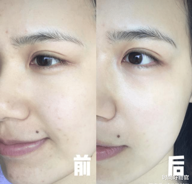 时尚好物官|宋智孝素颜出镜，38像18！网友：“换血美容”第一人，我换我也美