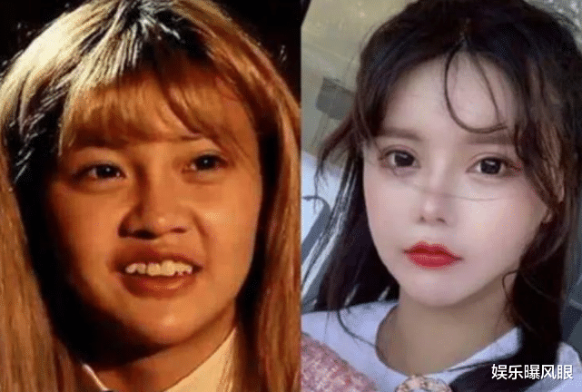 韩安冉|韩安冉脑部长瘤与整容有关，不治将双目失明，网友：自作自受