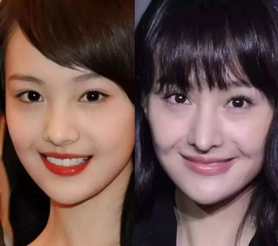 面相|郑爽代孕事件再升级，郑爽的面相预示着什么？