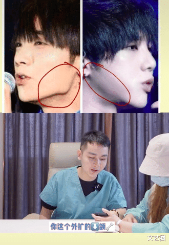 华晨宇|整容医生声称华晨宇做过5个整容项目，扬言见过本人皮肤很差，整容前更好看