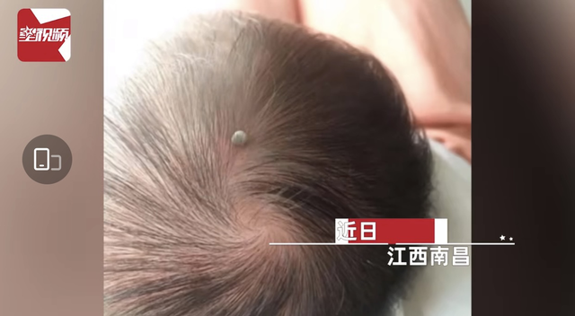 糯米妈妈育儿日记|夏天宝宝如何防止蚊虫叮咬，赶紧收好这份“夏日实用防虫手册”