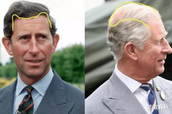 王子是“禿頭”，公主是凸嘴齙牙，英國王室的基因是被誰帶跑偏的-圖9