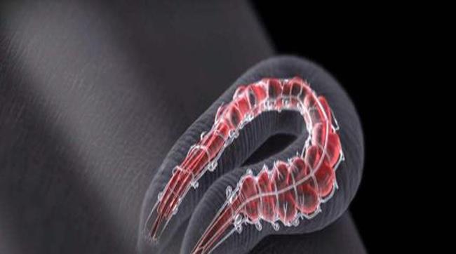 超导 水蛭是如何叮人的？被水蛭叮是种什么体验？