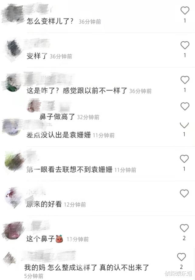 袁姗姗|袁姗姗近照大变样，被质疑整了鼻子撞脸姚笛，网友齐呼认不出