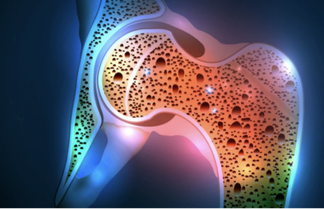 |养骨“冠军”被揪出，不是牛奶，每天当零嘴吃，脆骨变“钢骨”