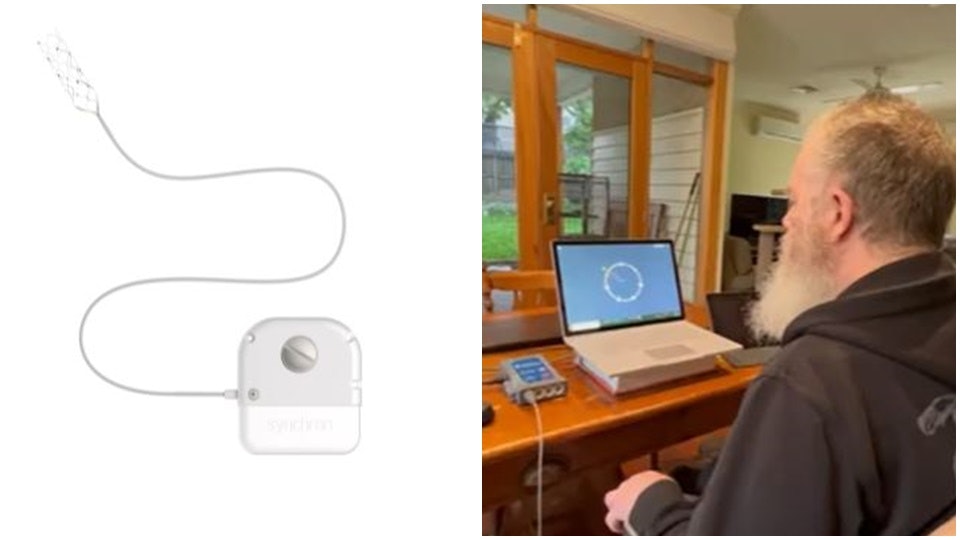 saas|澳洲瘫痪男安装脑机界面 用思想发布首个Twitter推文