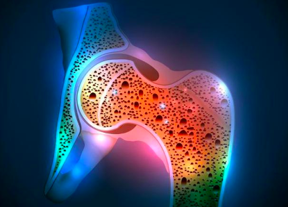 天天听健康|吃一口等于5斤筒骨，骨科主任：你若爱吃，骨骼硬朗，远离骨质疏松