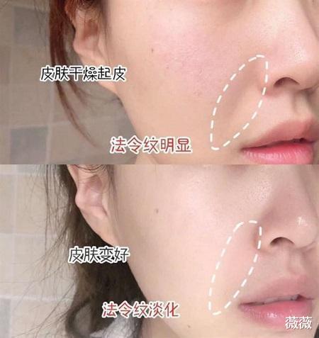 护肤 长期使用精华液，三年后皮肤会变成什么样子？说出来你或许不会信