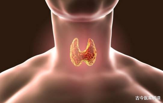 牛奶|牛奶是甲状腺结节的“发物”？医生：呵护甲状腺健康，3物还需忌嘴