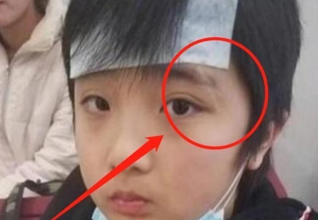 芒果台|他曾是“古惑仔老爸”，为了儿子手撕芒果台，如今儿子的疤还在