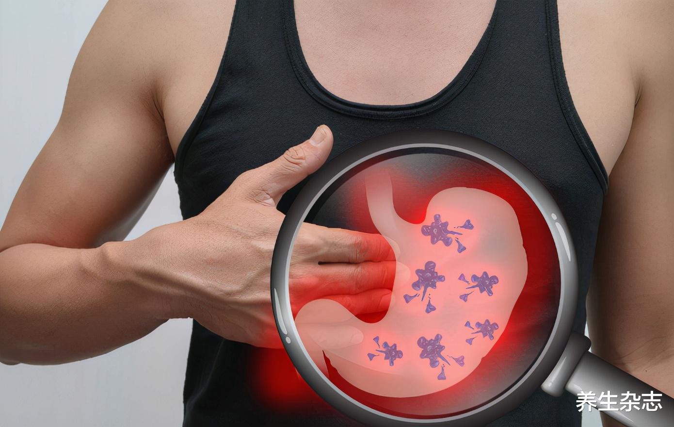 内卷|35岁男子“内卷”8年,确诊胃癌,化疗2次离世,大夫:“内卷”害人不浅