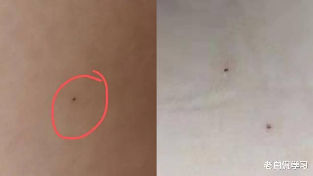 老白侃学习|愤怒！北京一所幼儿园被曝幼师拿针扎学生，点燃众多网友的怒火