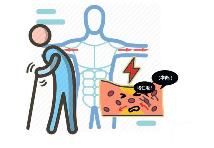 血栓|如何吃出“干净”的血管？4种食物每天适量吃，血管通畅，没血栓