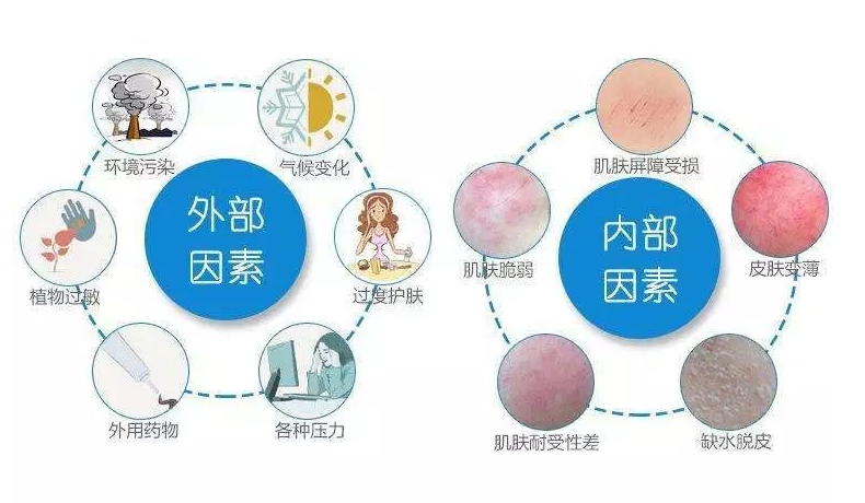 钻戒 秋冬季敏感肌肤的八种状态，错误的护肤方式，伤害了多少少女心