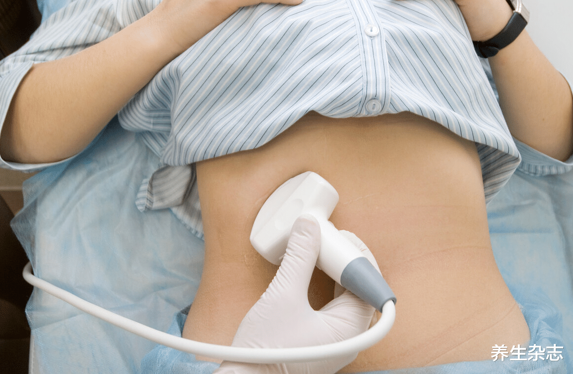 肝脏|32岁女子常吃“1素”，转氨酶从86降到34，口臭没了、斑也淡了