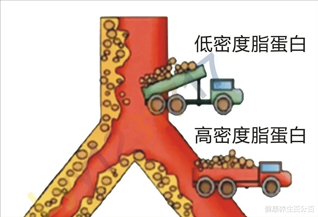 心脏病|如何改善心脏健康？日常6个关键点，让你远离心脏病，身体更健康