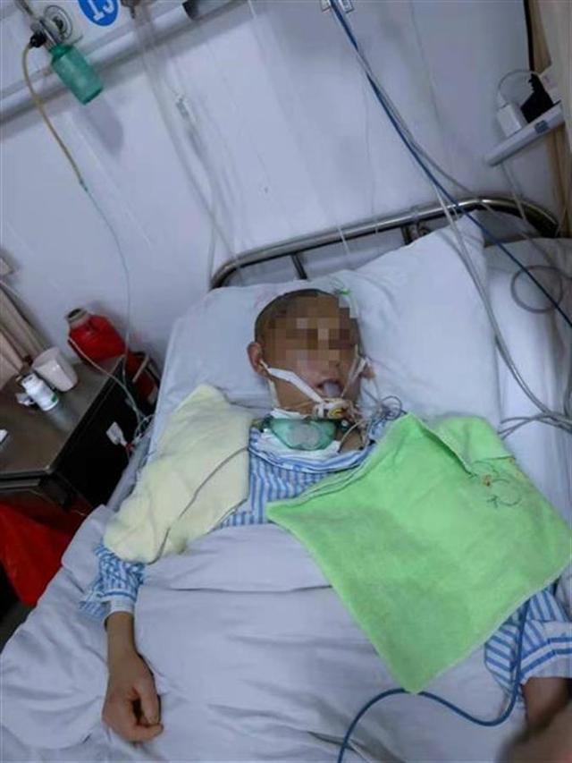 潮评社 福建一女子遭家暴头骨开裂昏迷63天，警方已立案