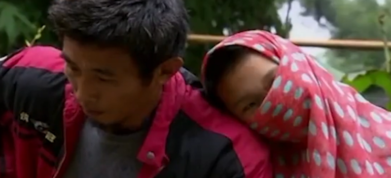 蹦极 那个全脸都是弹片的女孩